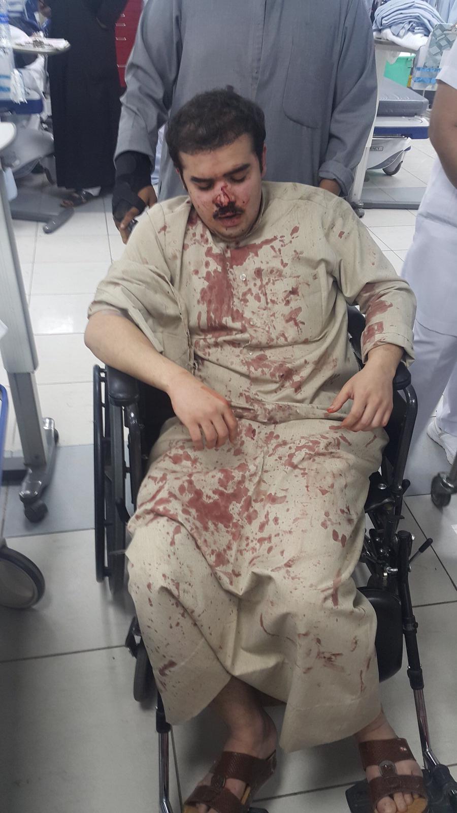 مجهولون يعتدون على محمد العنزي